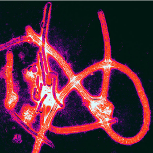 Ebola-Virus